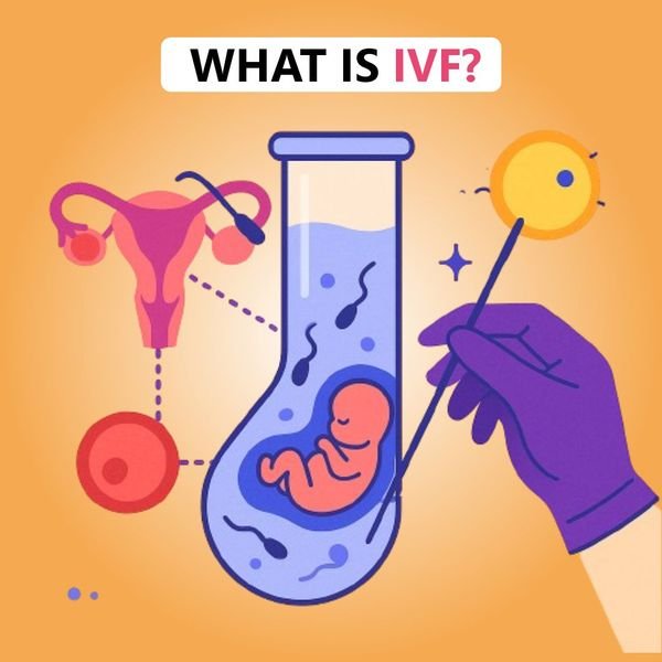 IVF Treatment