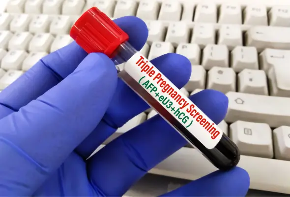Triple Marker Test